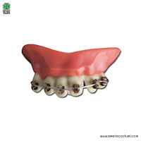 False dentures with braces