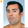 Dentadura BRACES