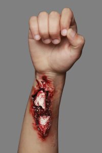 Appliance Broken Arm