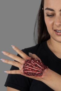 Appliance Tendon injury