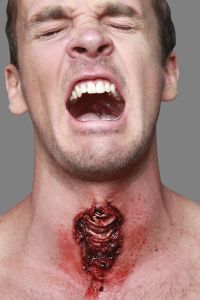 Appliance traqueotomy
